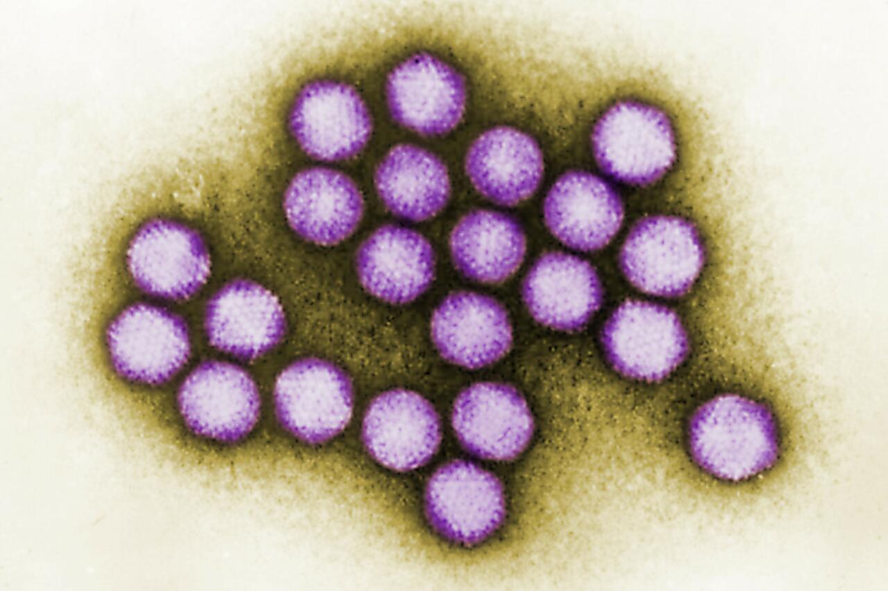 9th child dies in adenovirus outbreak at NJ health facility, Health Department confirms