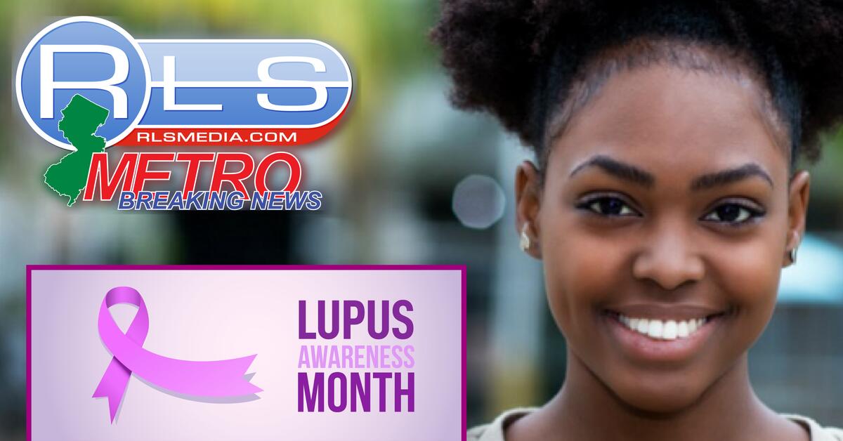 LUPUS Living With, Managing This Chronic Disease