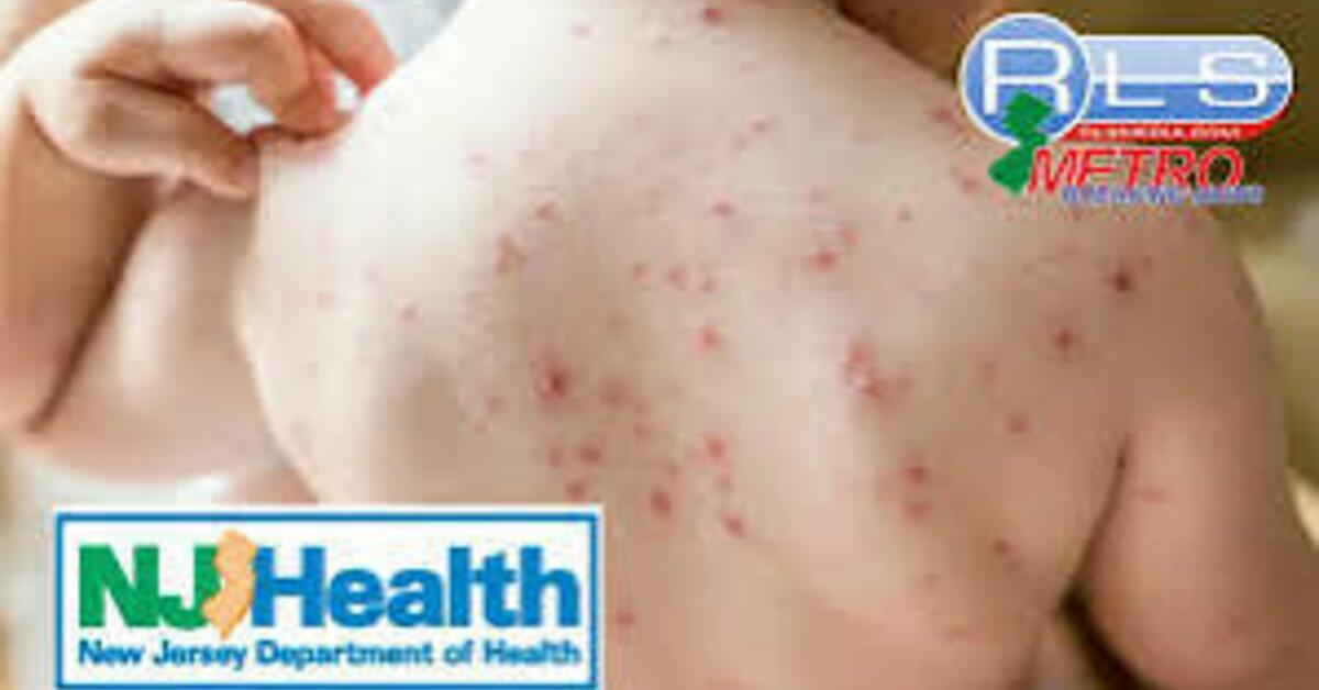 Measles Resurgence Raises Concern in New Jersey as National Outbreak Spreads