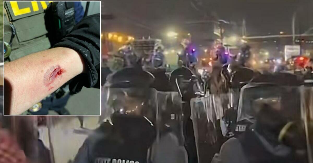 NJ Man Accused of Biting Two Federal Officers at Delaney Hall Demonstration